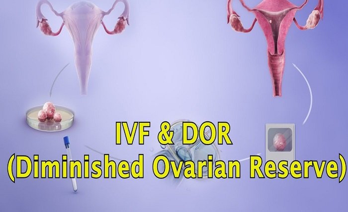 Diminished Ovarian Reserve